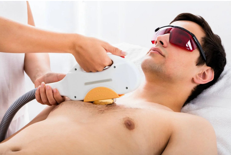 Perfect Laser Hair Removal